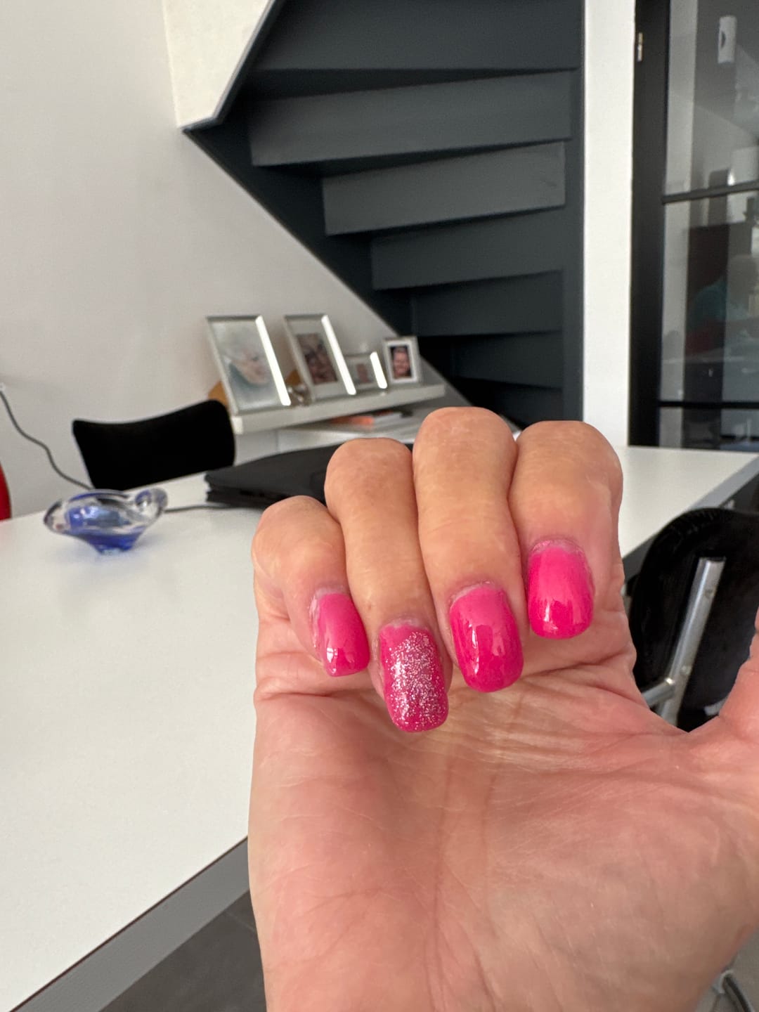 Customer photo review of Peel Off Base Coat