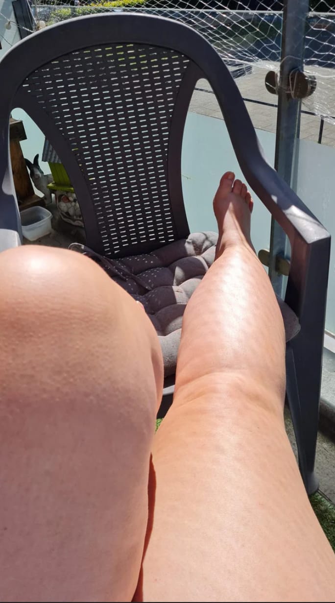 Customer photo review of Épilation Définitive Professionnelle à la Lumière Pulsée IPL™