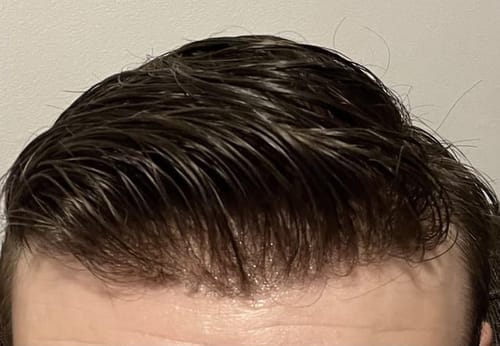 Customer hair result