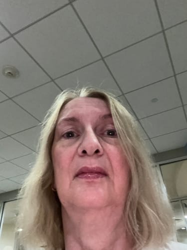 Customer photo review of Grass Fed Tallow & Honey Balm