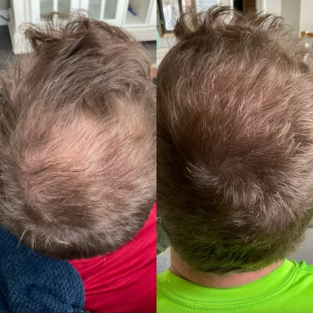 Customer photo review of Reverse - Hair Growth Serum