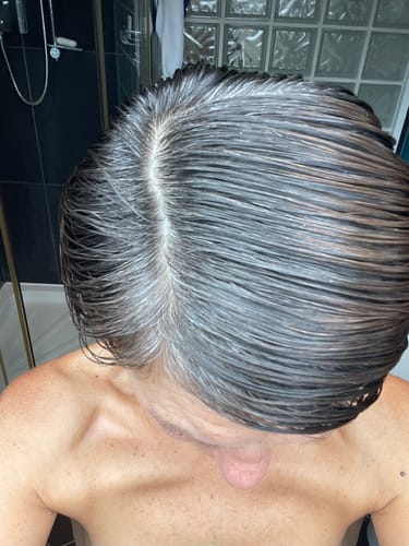 Customer photo review of Seb Natural Calming Serum