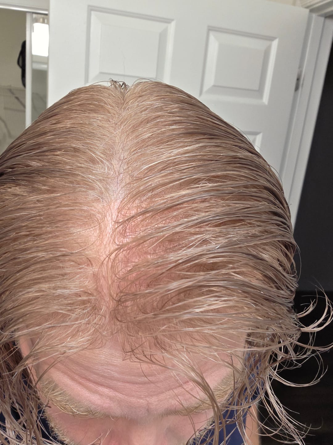 Customer photo review of Men Toupee V-loop 0204mm Ultra-thin skin base Sage