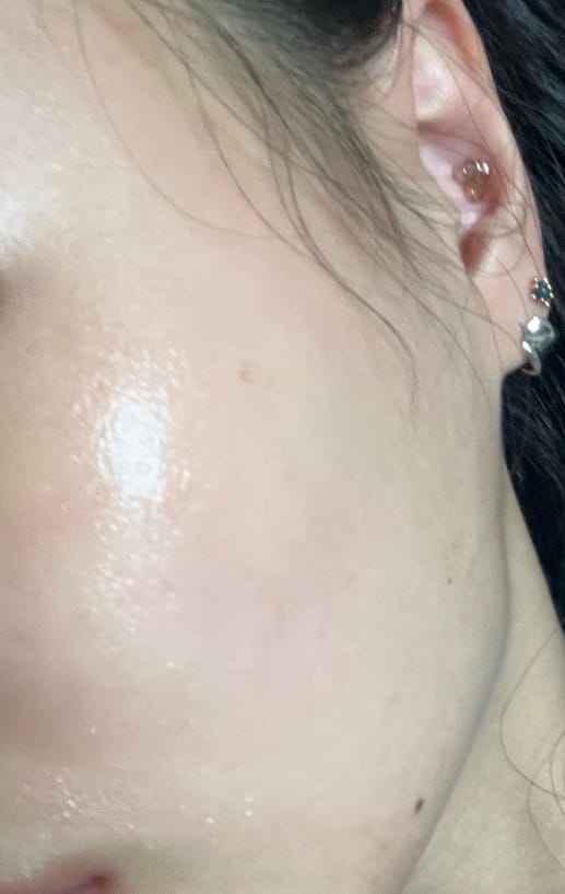 Customer photo review of Madeca Mela Capture Ampoule Pad 60pcs