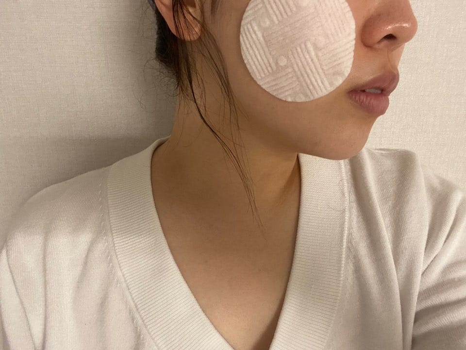 Customer photo review of Madeca Mela Capture Ampoule Pad 60pcs