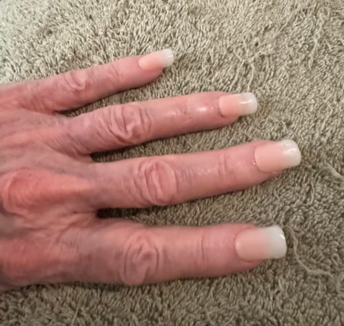 Customer photo review of Nail Glue - XCOATTIPS Gap - Filled Solid Gel 30g