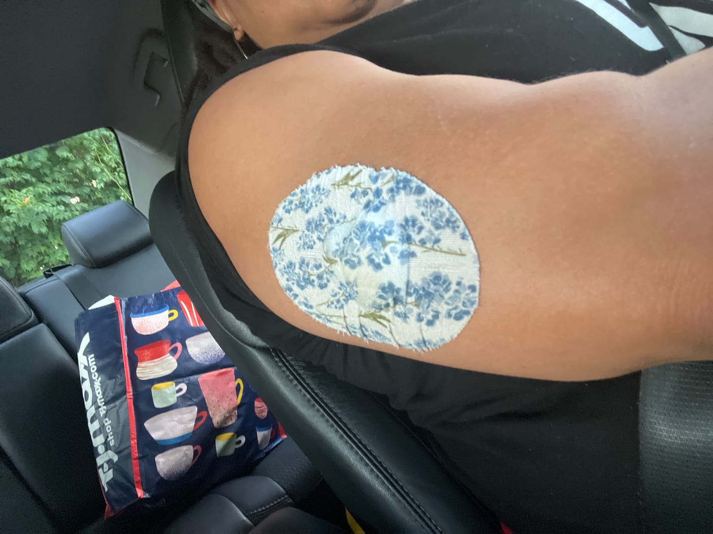 Customer photo review of Skin Grip Original - Medtronic Guardian/Enlite Adhesive Patches