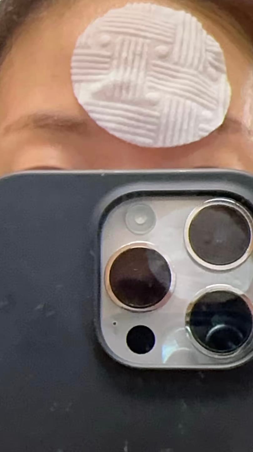 Customer photo review of Madeca Mela Capture Ampoule Pad 60pcs