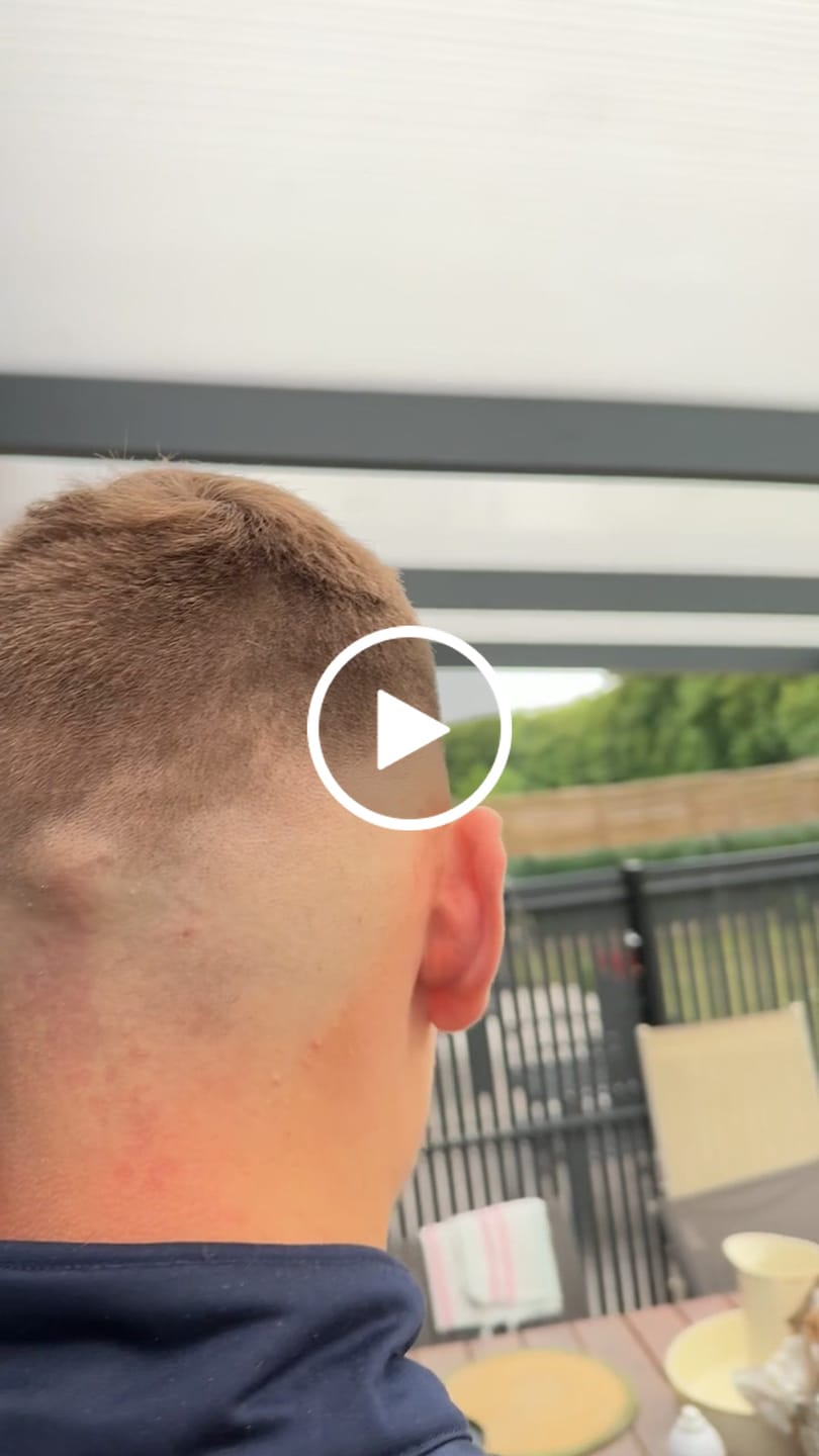 Customer video review of SF1 Tondeuse de coupe