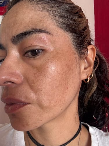 Customer photo review of Seyoul™ Suero 21 Días - H01