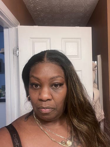 Customer photo review of Hold Me Down™ Adhesive Skin Guard (Ain’t No Other™)