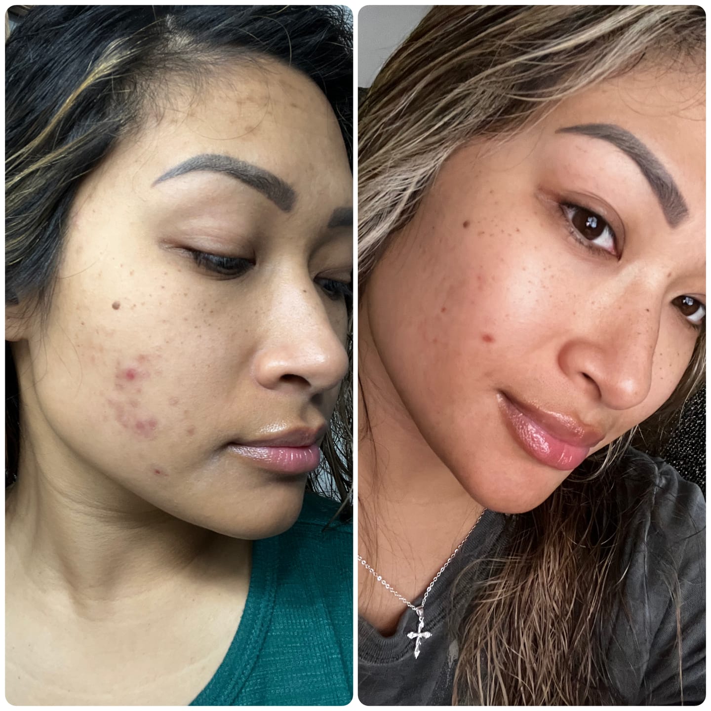 Customer photo review of Exfoliating Soap