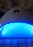 Customer photo review of NUVEX Multi-Nail LED Anti-Fungus Kit