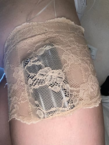 Customer photo review of Lace Garter For insulin Pump - Dia-Lacy Leg Band