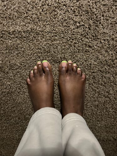 Customer photo review of XCOATTIPS® Toe Nail - Short Squoval - Pastel French