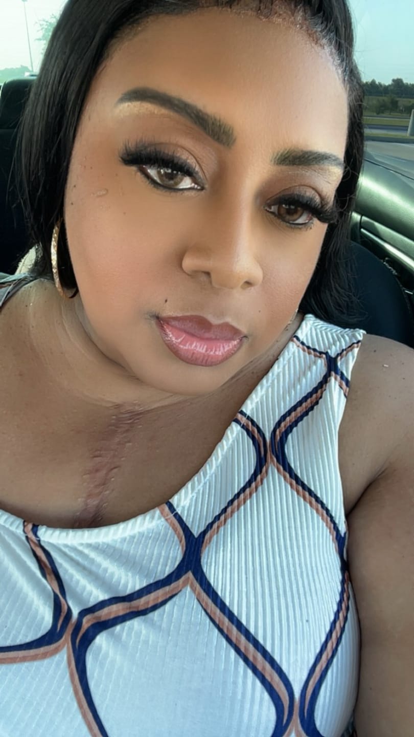 Customer photo review of Americano Brown Prescription Coloured Contact Lenses