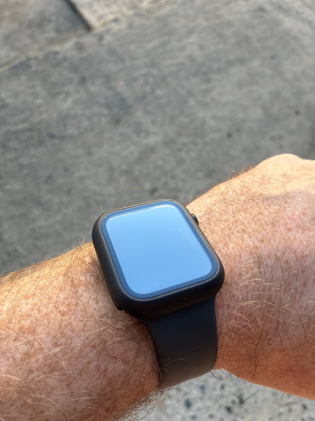 Customer photo review of All-in-one classic Apple Watch Protection Case