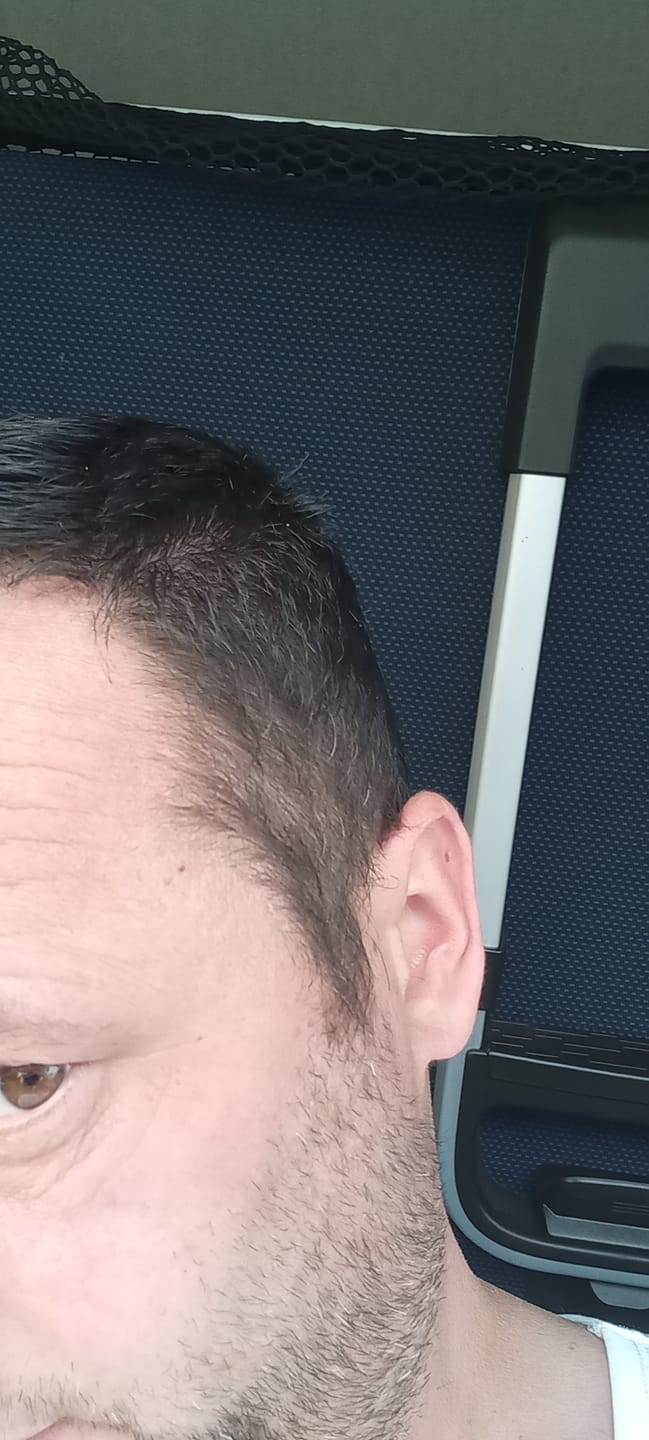 Customer photo review of GR-7 PRO