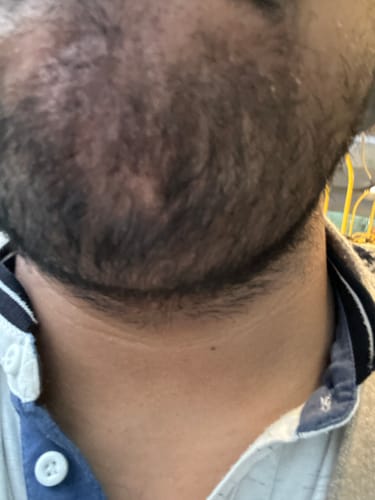 Customer photo review of Seb Natural Calming Serum