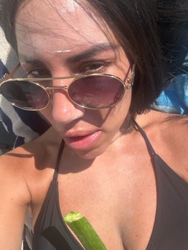 Customer photo review of WrinkleFix: Unlimited Toxins Membership