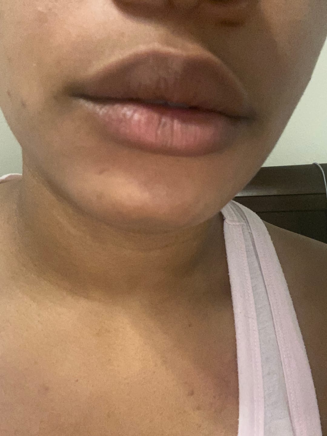 Customer photo review of Turmeric and Lemon Lip Balm (for Dark Lips)