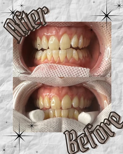 Customer photo review of Tooth Gem Course