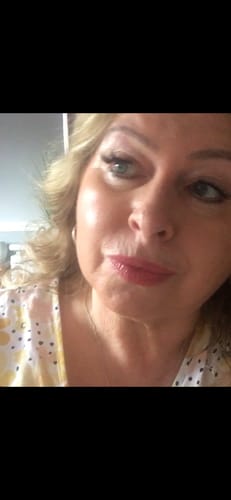 Customer photo review of 5-Step Clear Skin Kit