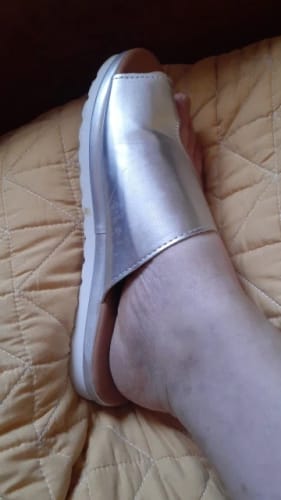 Customer photo review of HexoBunion™ Orthopedic Bunion Corrector Sandals