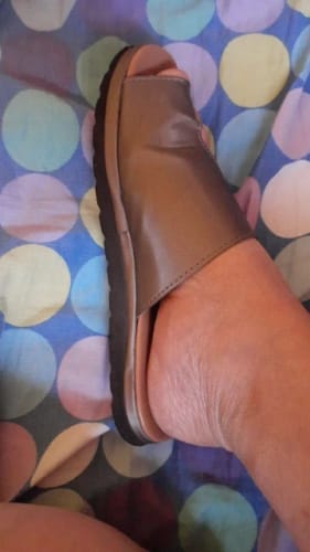 Customer photo review of HexoBunion™ Orthopedic Bunion Corrector Sandals