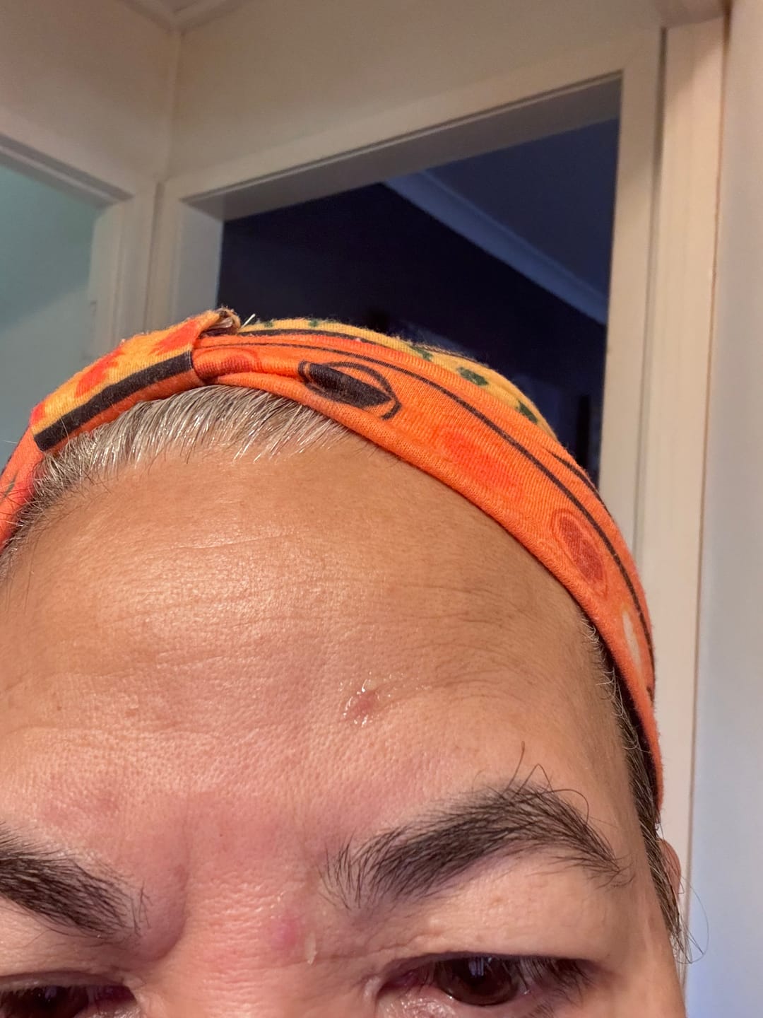 Customer photo review of DermaGen Manuka Soothing Butter - Specifically for delicate, sensitive, or reactive skin.