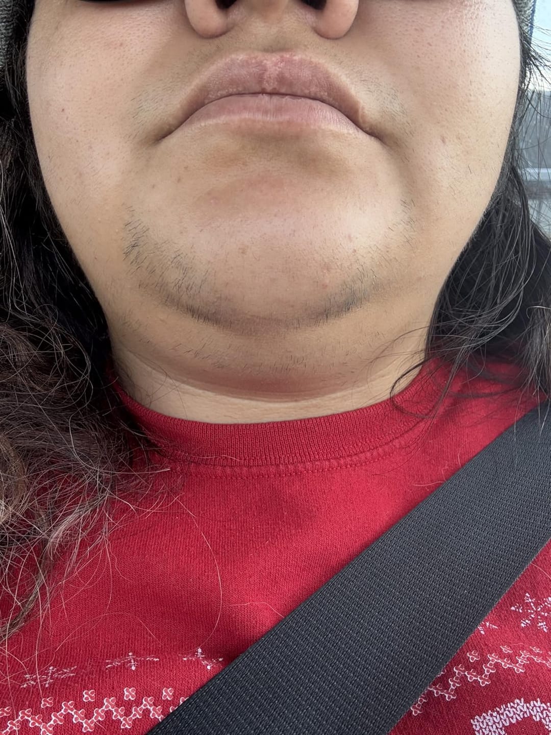 Customer photo review of Painless Facial Hair Removal Cream