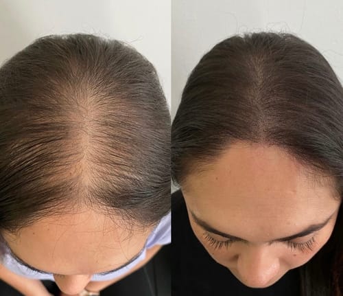 Customer photo review of Infrarot Lichttherapie Kappe™