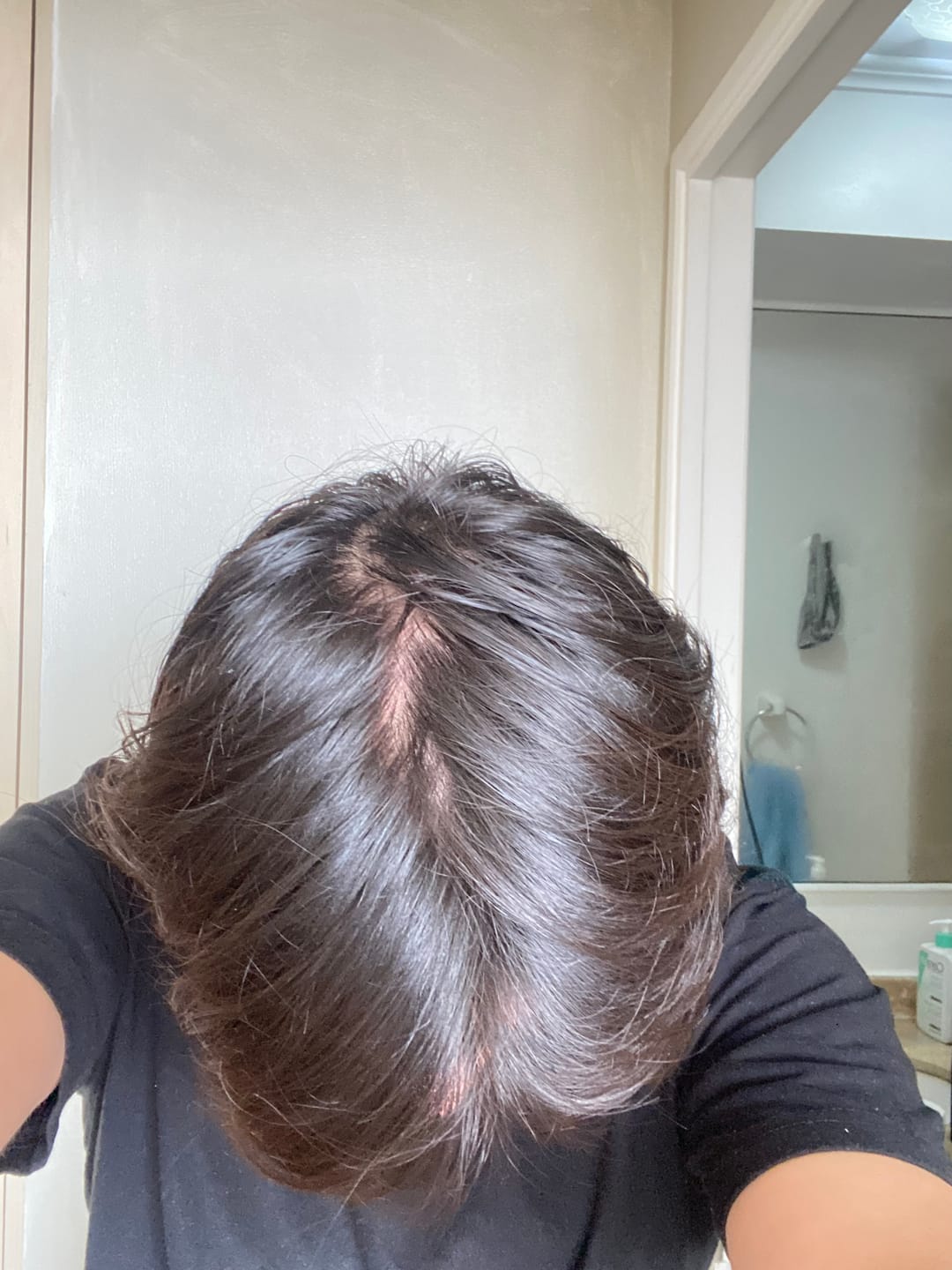 Customer photo review of 3 MESES de DÚO ANTIcaída CRECIMIENTO INTENSIVO Bomba + Tónico ENVÍO GRATIS