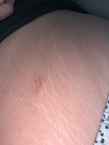 Customer photo review of Rituel : Soin revitalisant vergeture