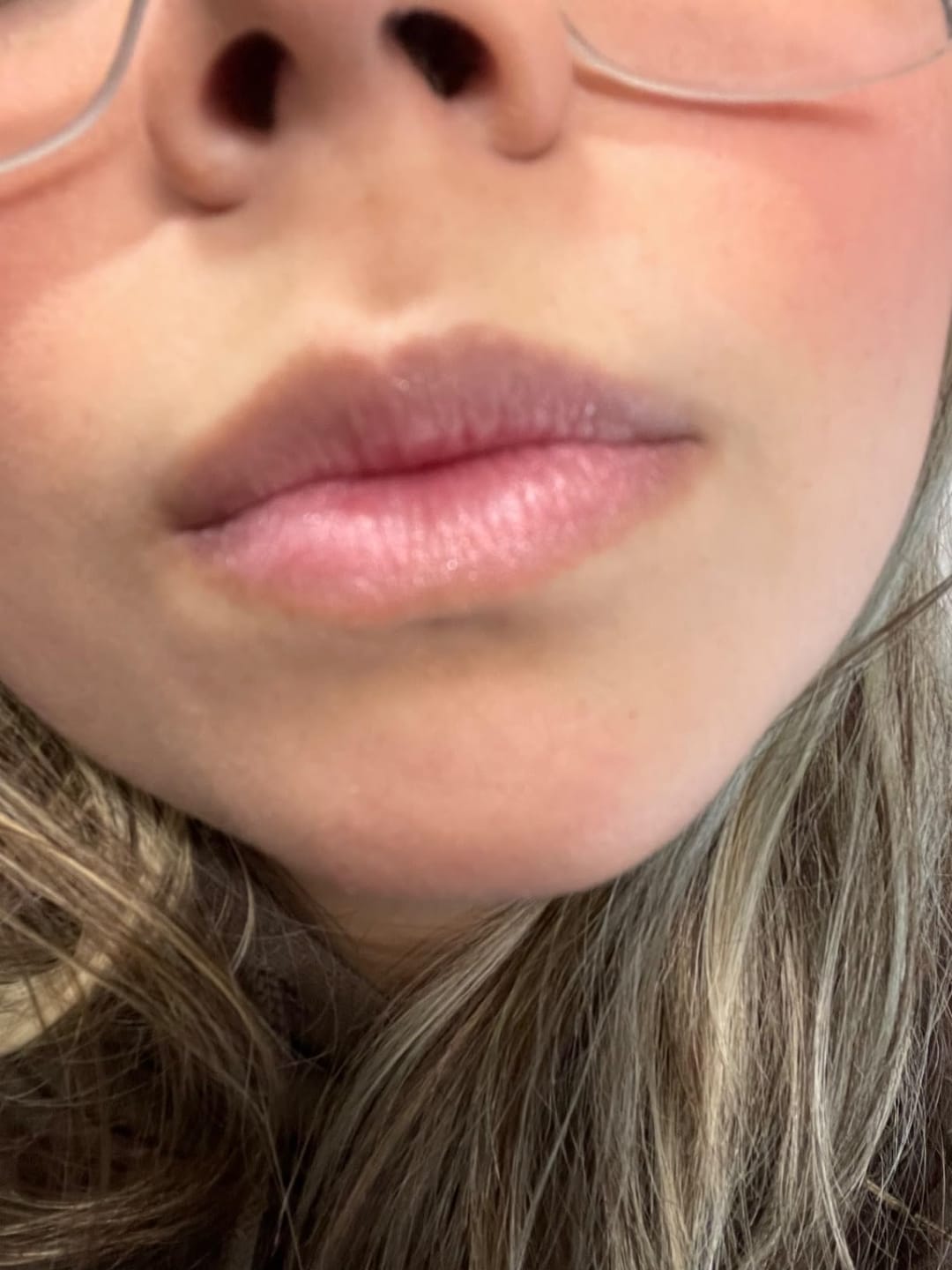 Customer photo review of Painless Facial Hair Removal Cream