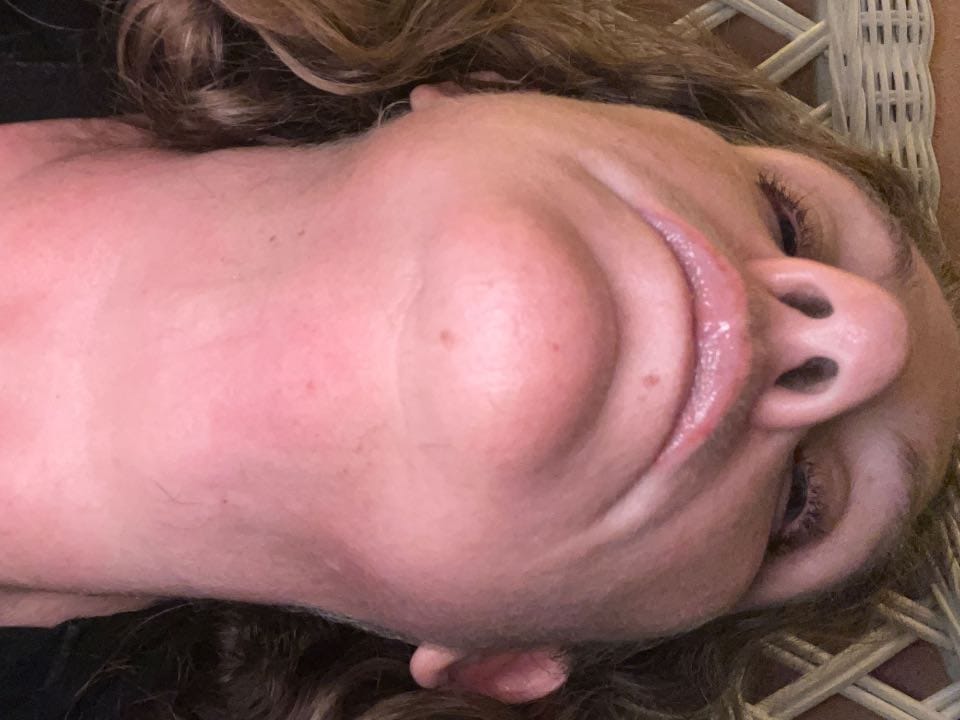 Customer photo review of Painless Facial Hair Removal Cream
