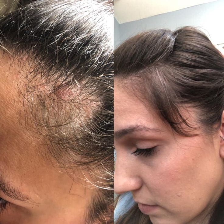 Customer photo review of Pack Caspa Seca y Psoriasis: Shampoo Detox Hidratante en barra + Tónico Calmante 100 ml | Para caspa seca, picazón o brotes