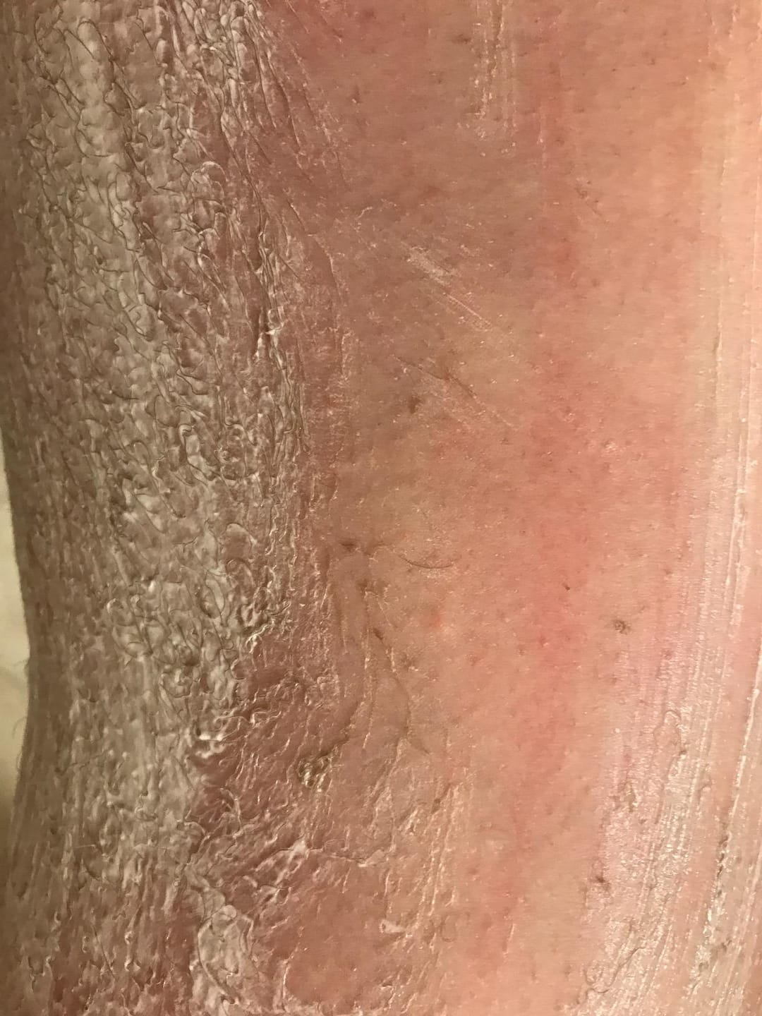 Customer photo review of Painless Facial Hair Removal Cream