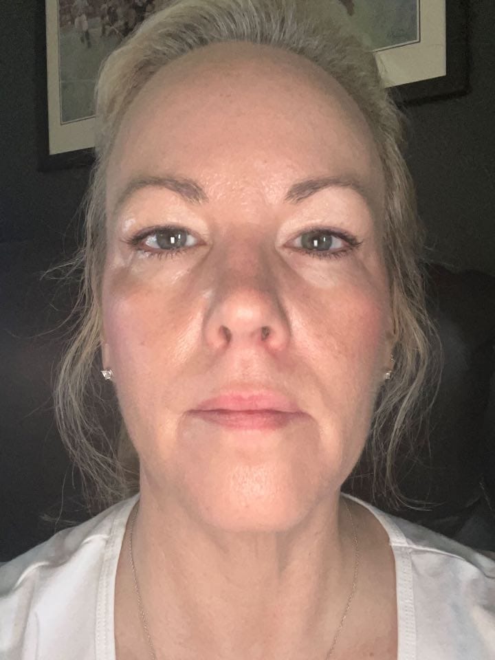Customer photo review of Painless Facial Hair Removal Cream
