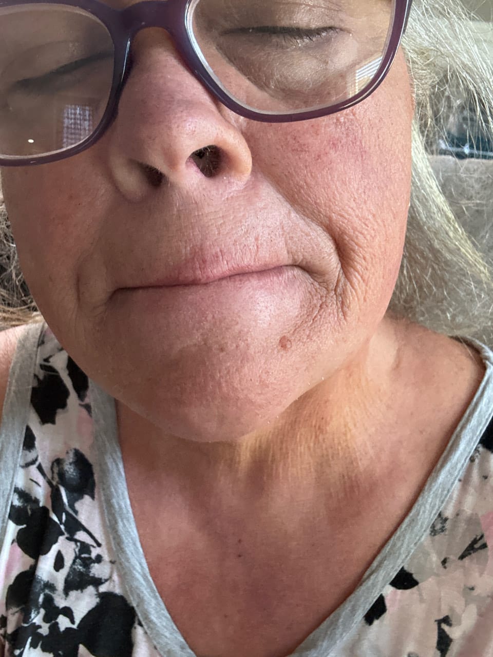 Customer photo review of Painless Facial Hair Removal Cream