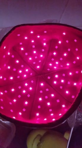 Customer photo review of Infrarot Lichttherapie Kappe™