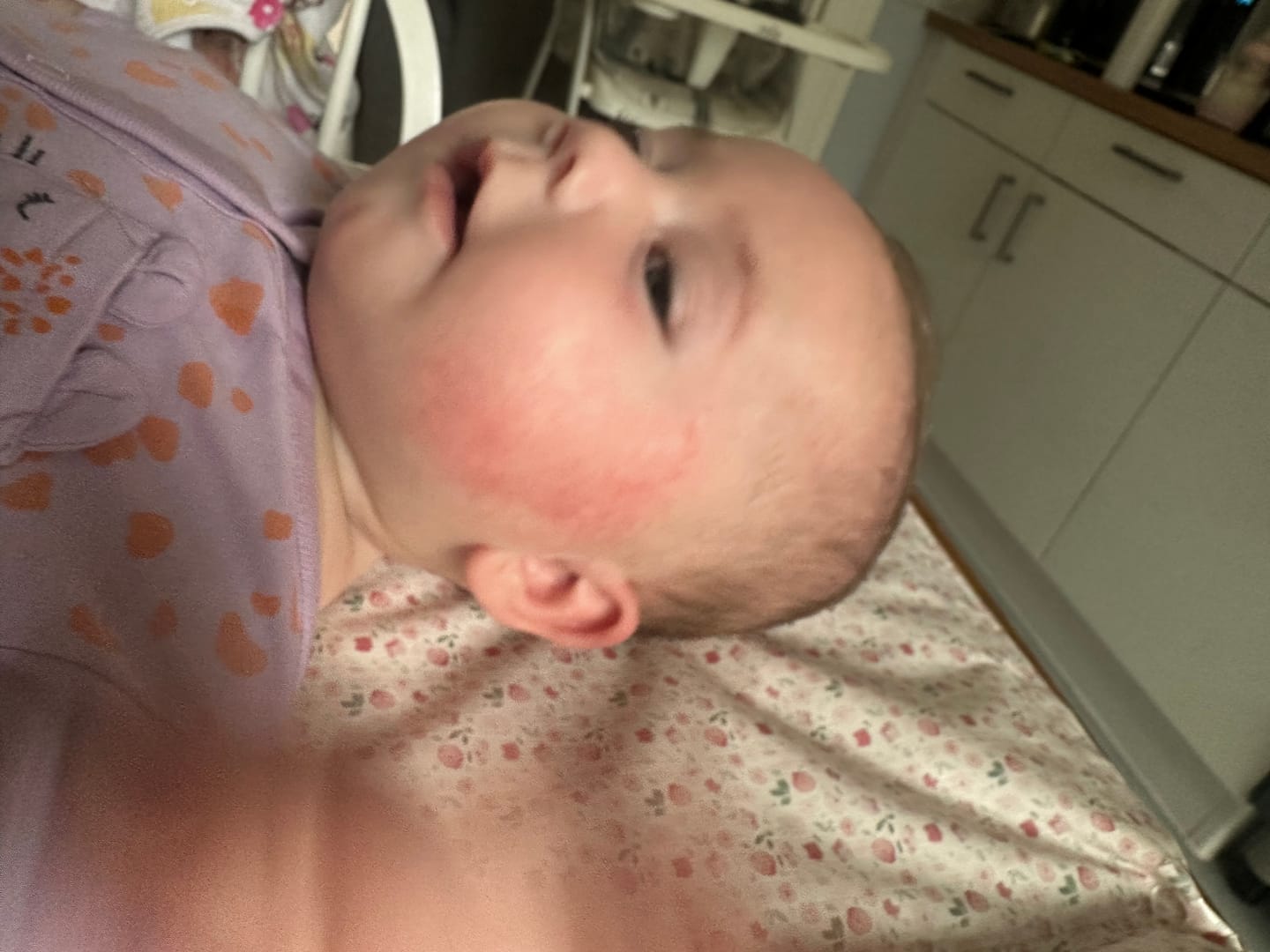 Customer photo review of Bioskin Junior Outbreak Rescue Cream