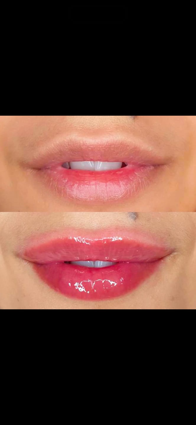 Customer photo review of Premium Korean Lip Plumper