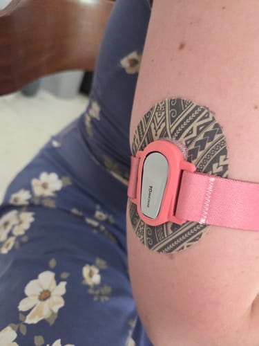 Customer photo review of Dexcom G6 Sensor Adjustable Armband - Dia-Style Barbie Edition
