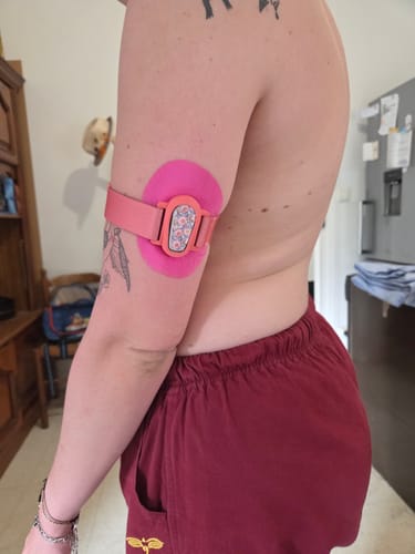 Customer photo review of Dexcom G6 Stickers - Summer Edition