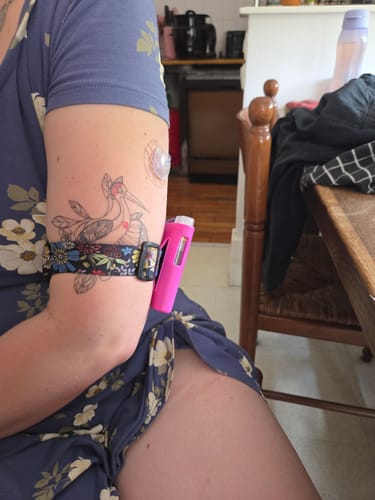 Customer photo review of Wear your insulin pump on your arm - Dia-Arm Band