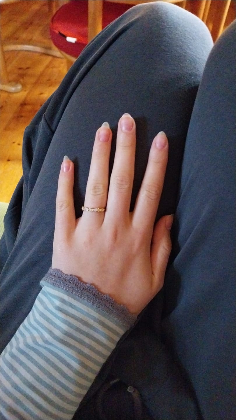 Customer photo review of Rosenquarz Ring - Natursteine
