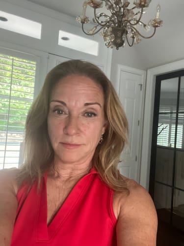 Customer photo review of Glov Hair Regrowth System