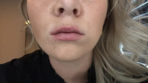Customer photo review of COSTIQ® LONG LASTING LIP PLUMPER