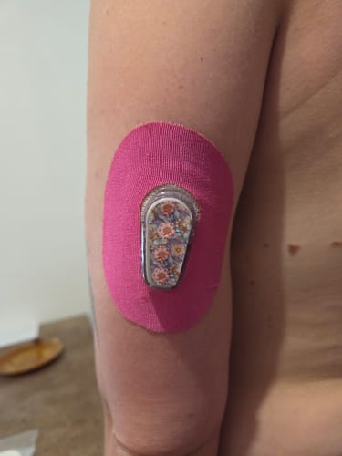 Customer photo review of Dexcom G6 Stickers - Spring Edition 2025